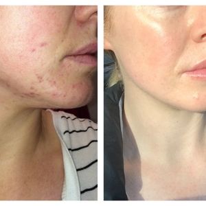 Vegan Spa Exfoliating Peeling Body & Face Glove